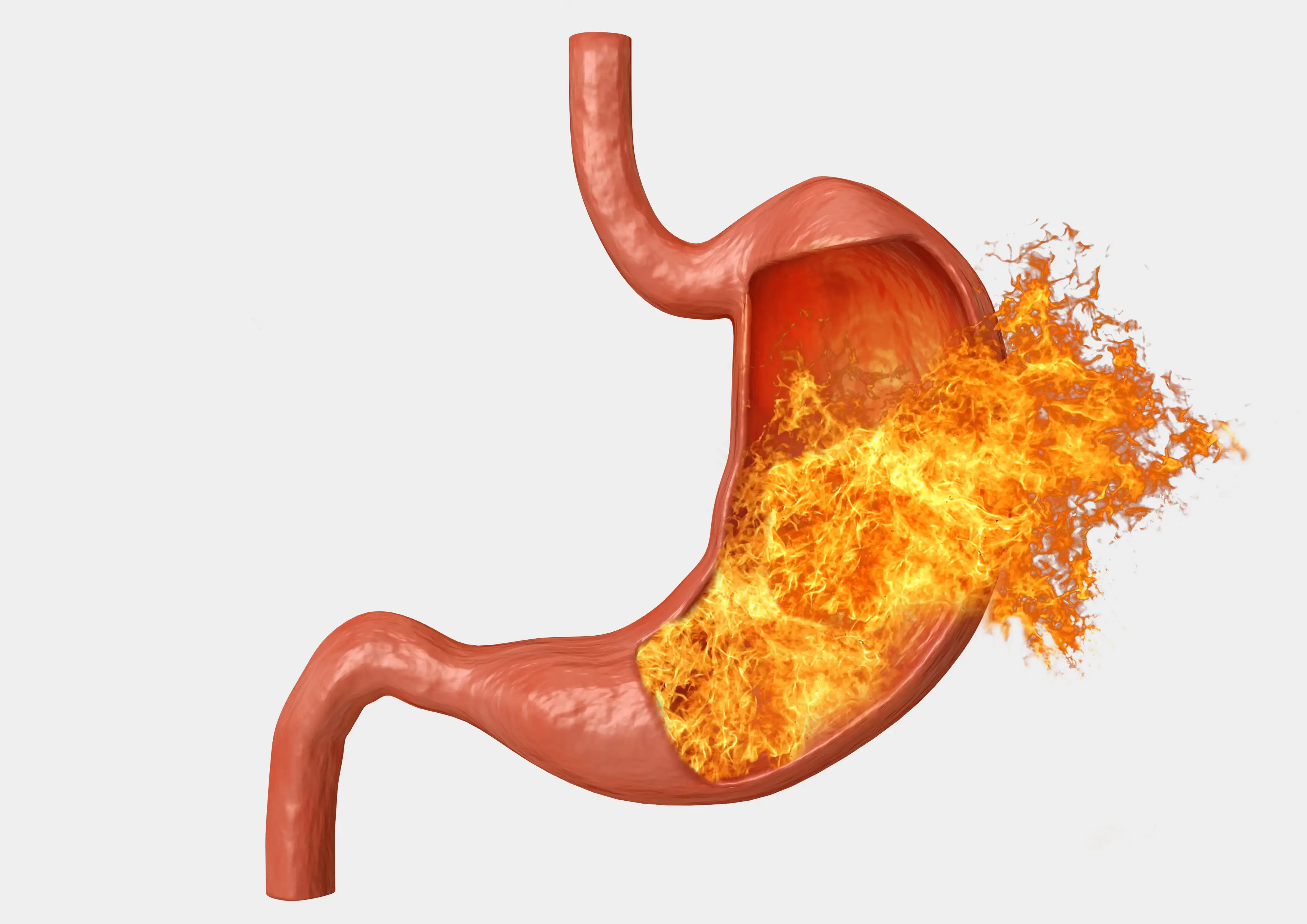 H. pylori