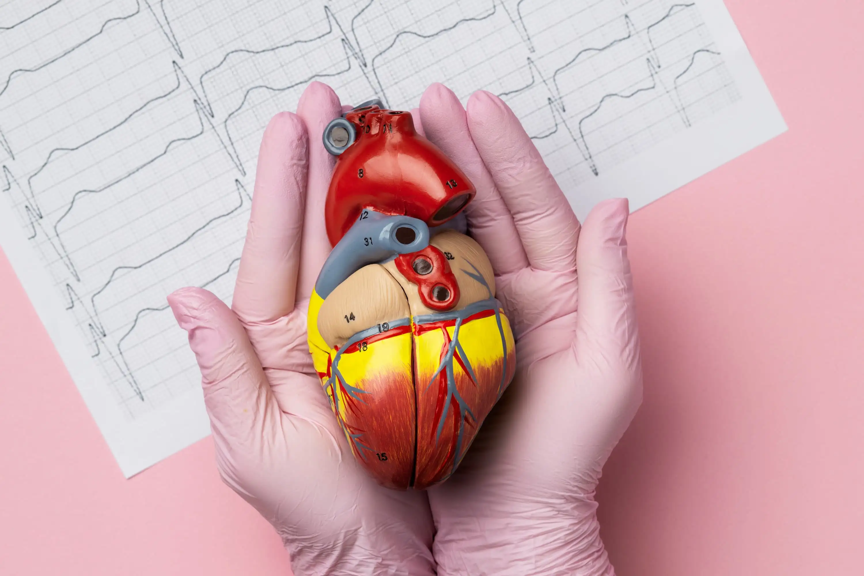 Cardiac cephalalgia