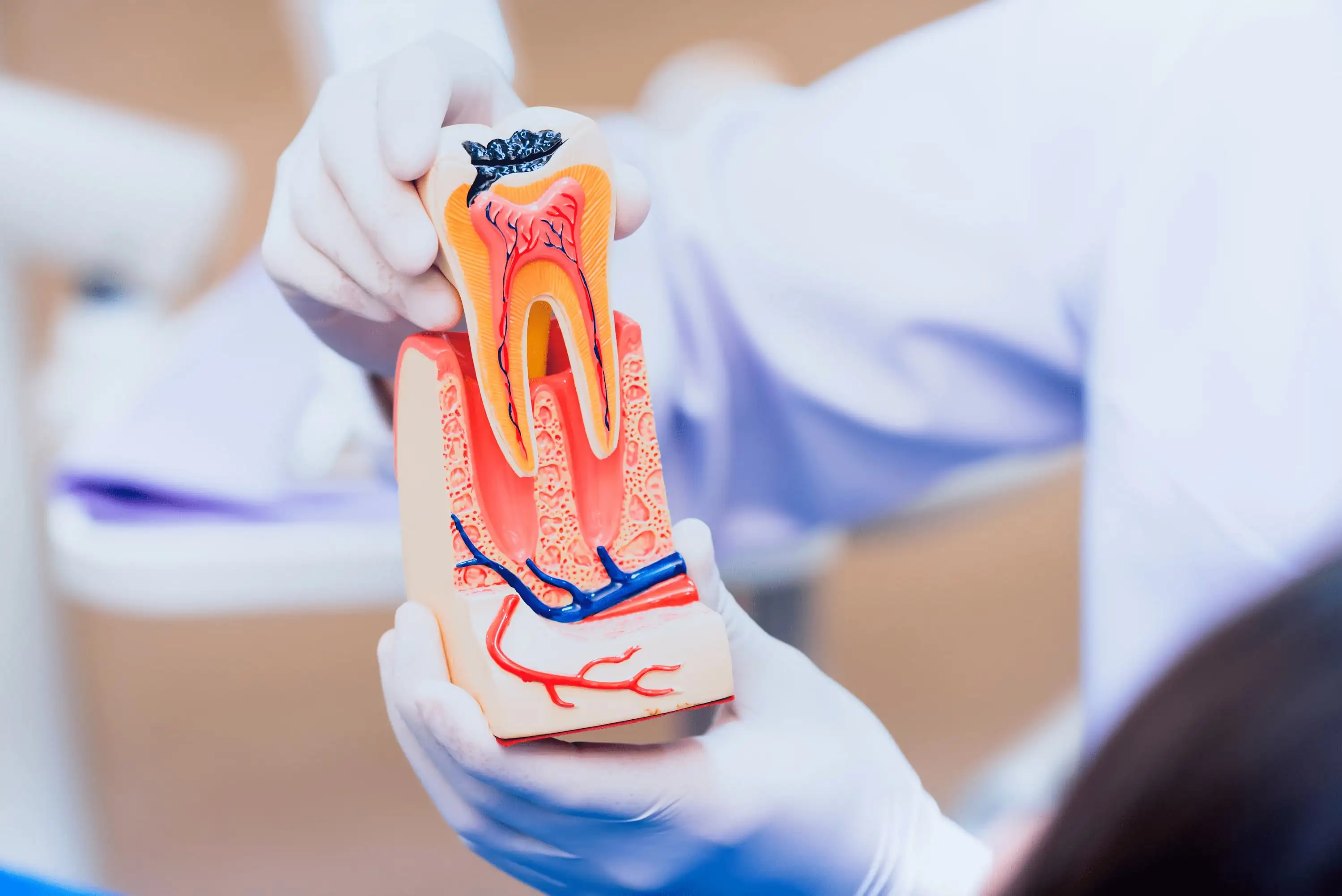 Periodontitis