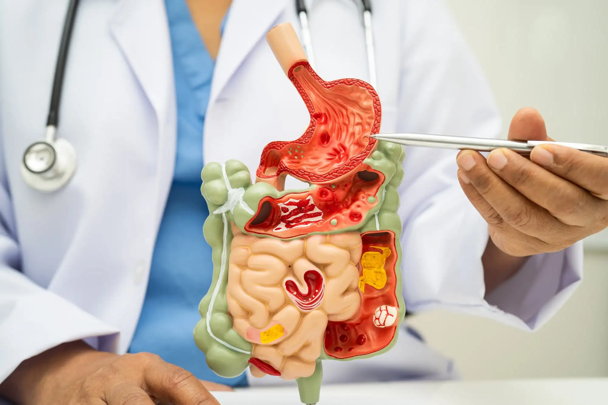 Gastrointestinal bleeding