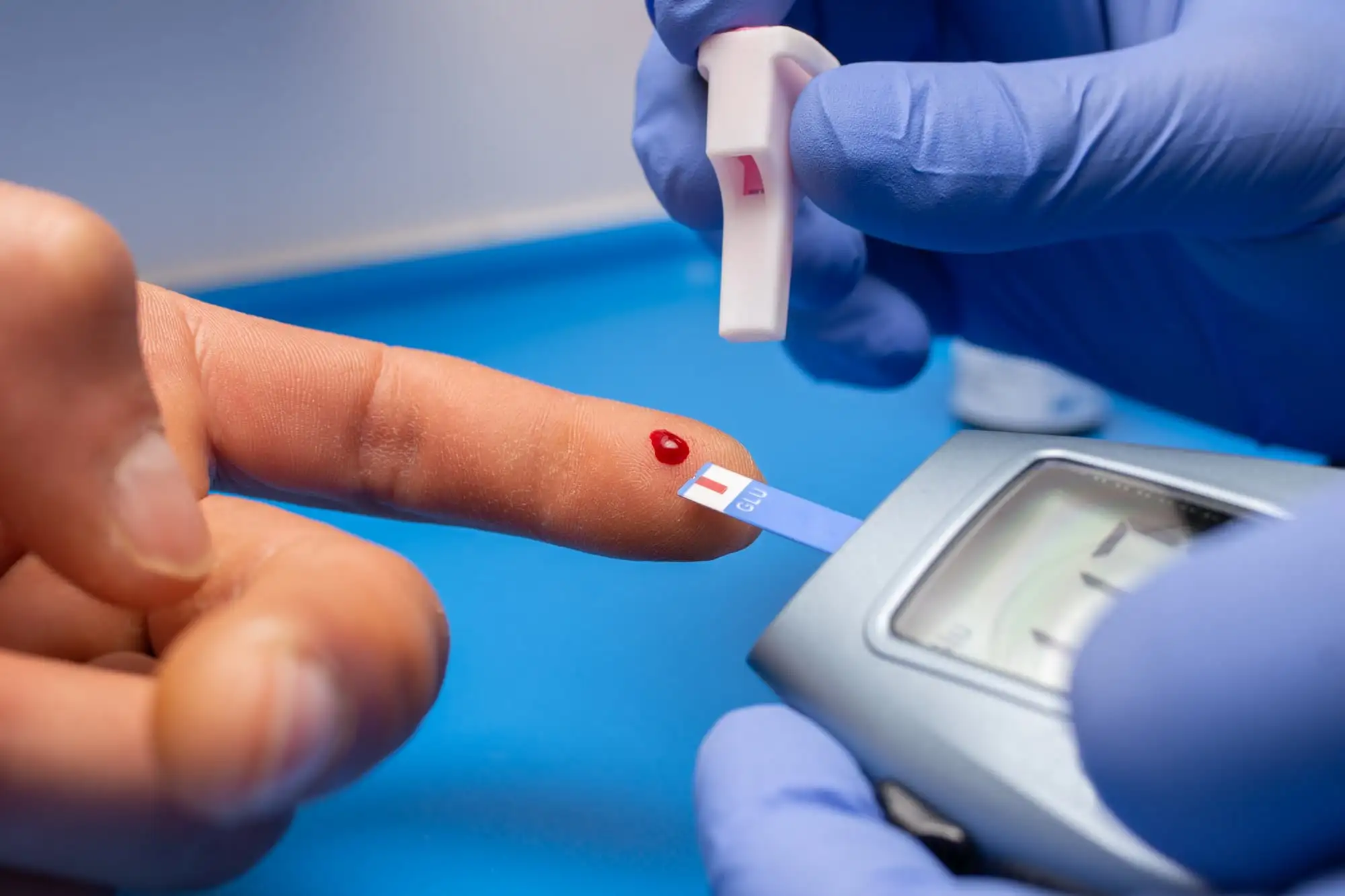 Type 2 diabetes mellitus