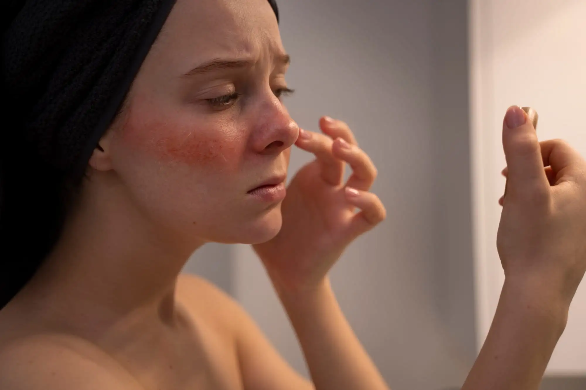 Skin diseases