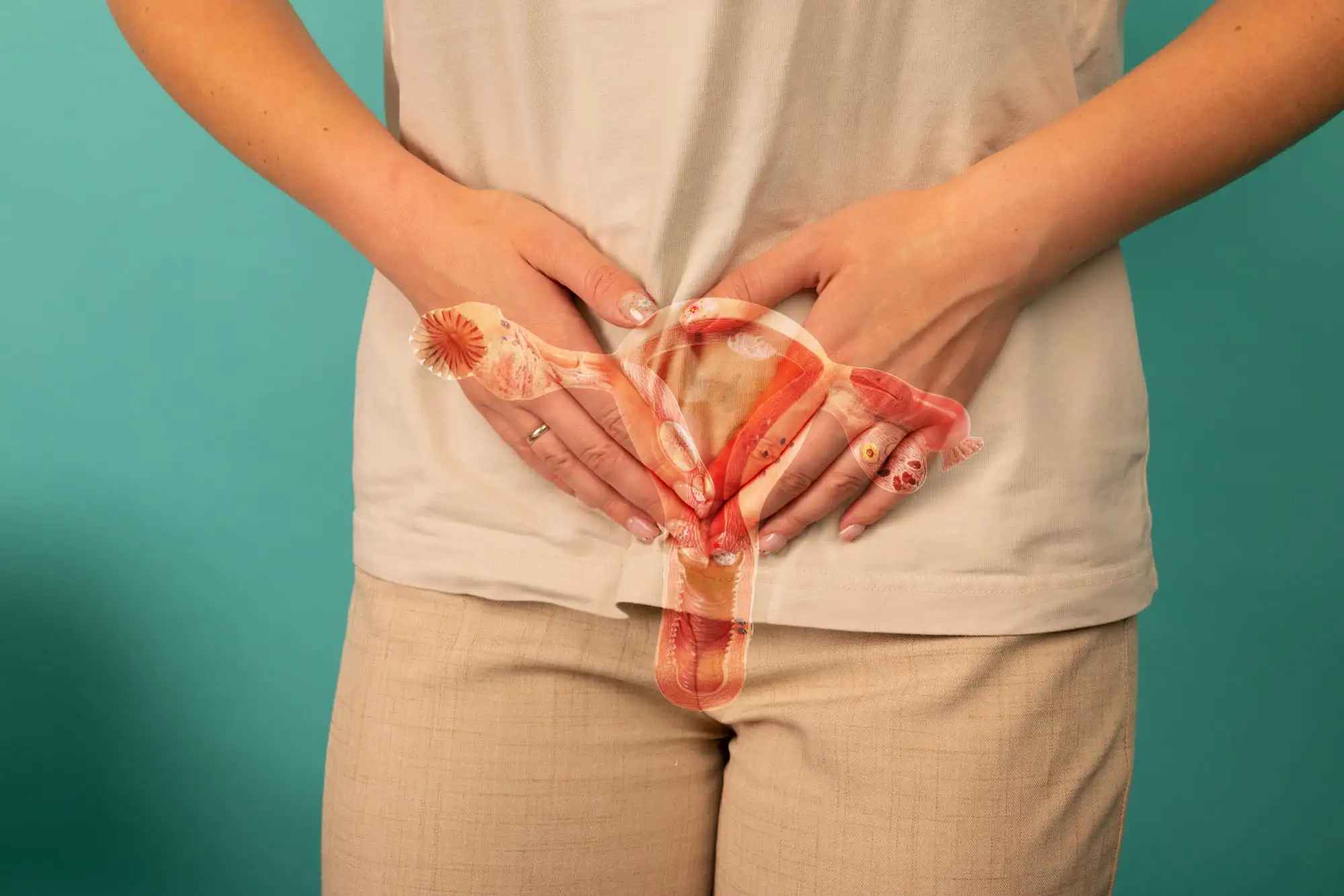 Bacterial vaginosis
