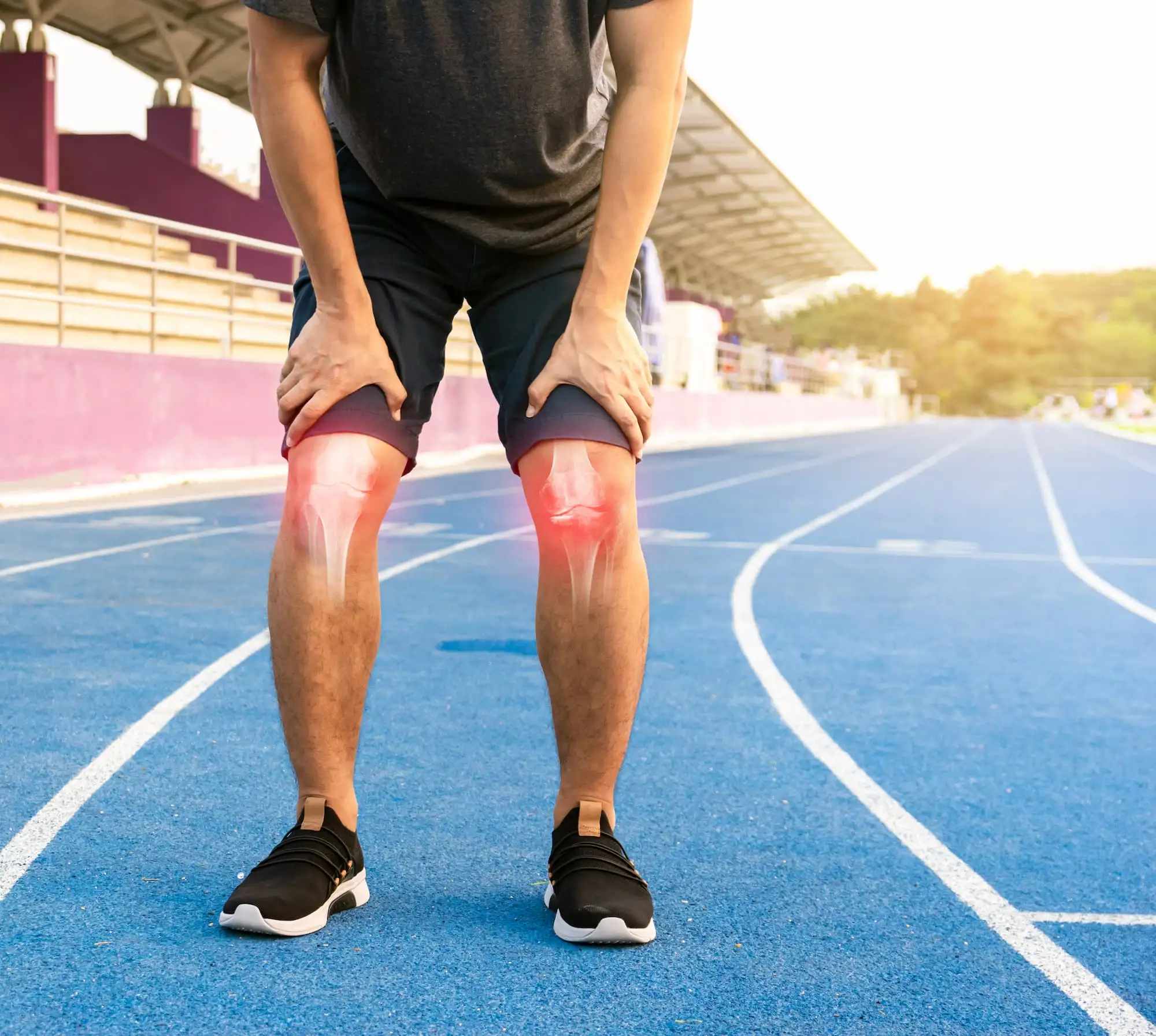 Knee osteoarthritis