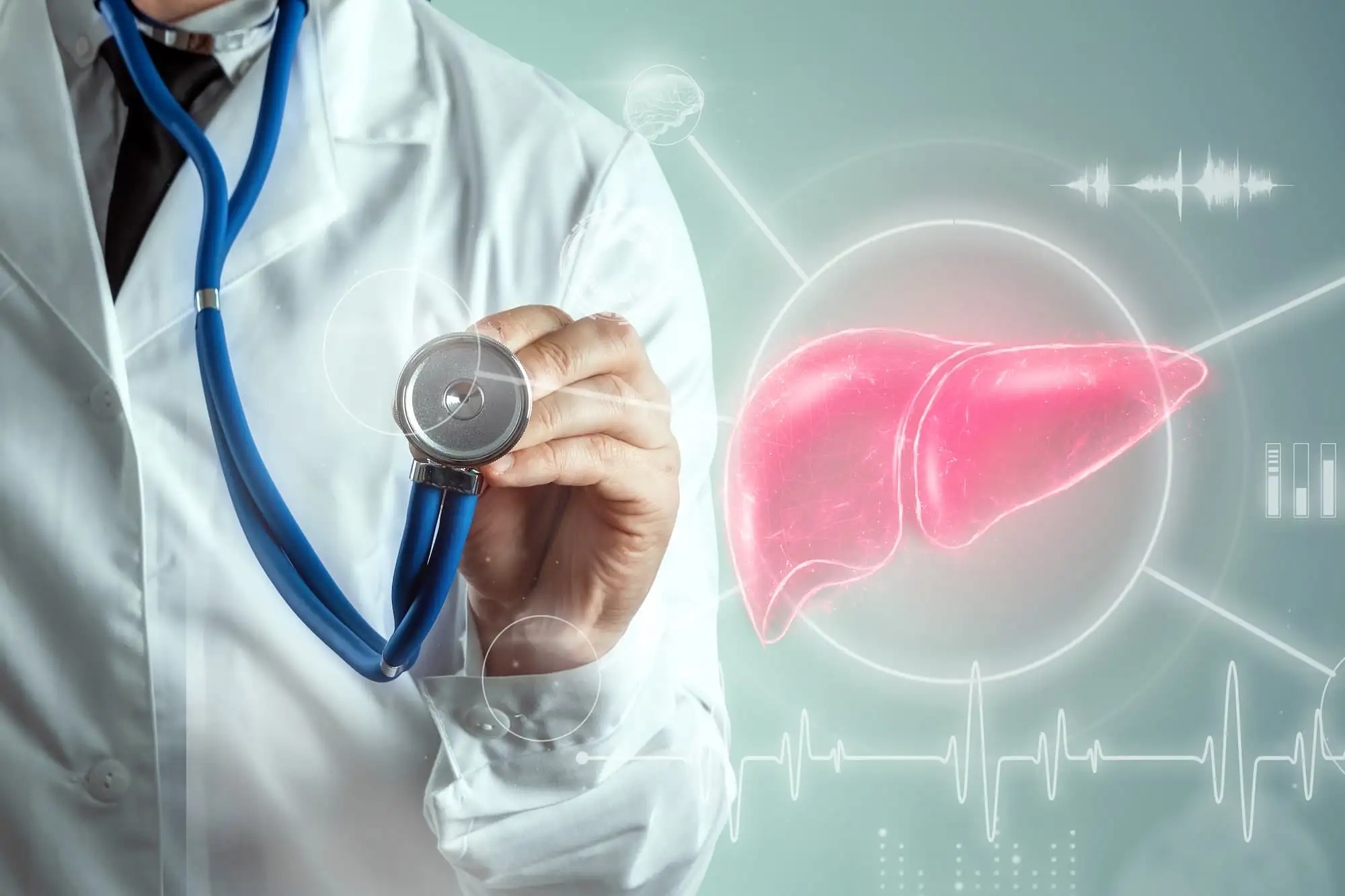 NAFLD, Primary biliary cholangitis