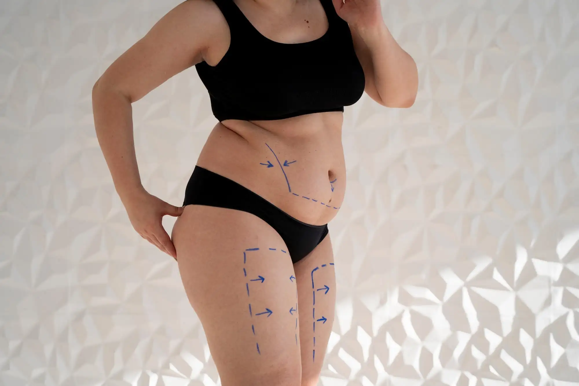 Obesity, Surgery