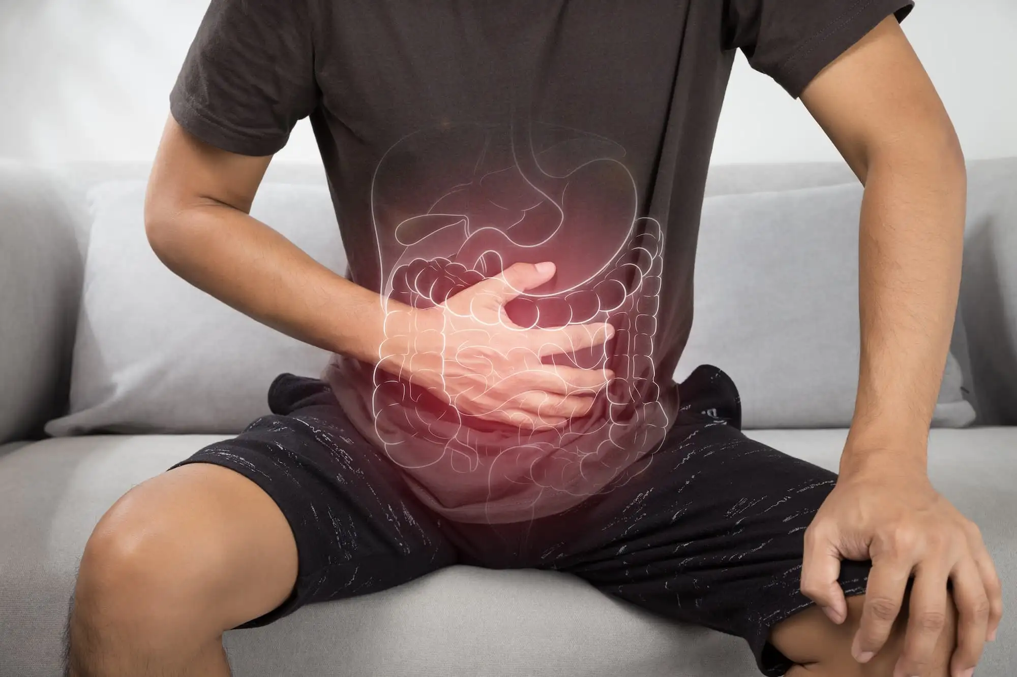 Functional bloating, Abdominal distension
