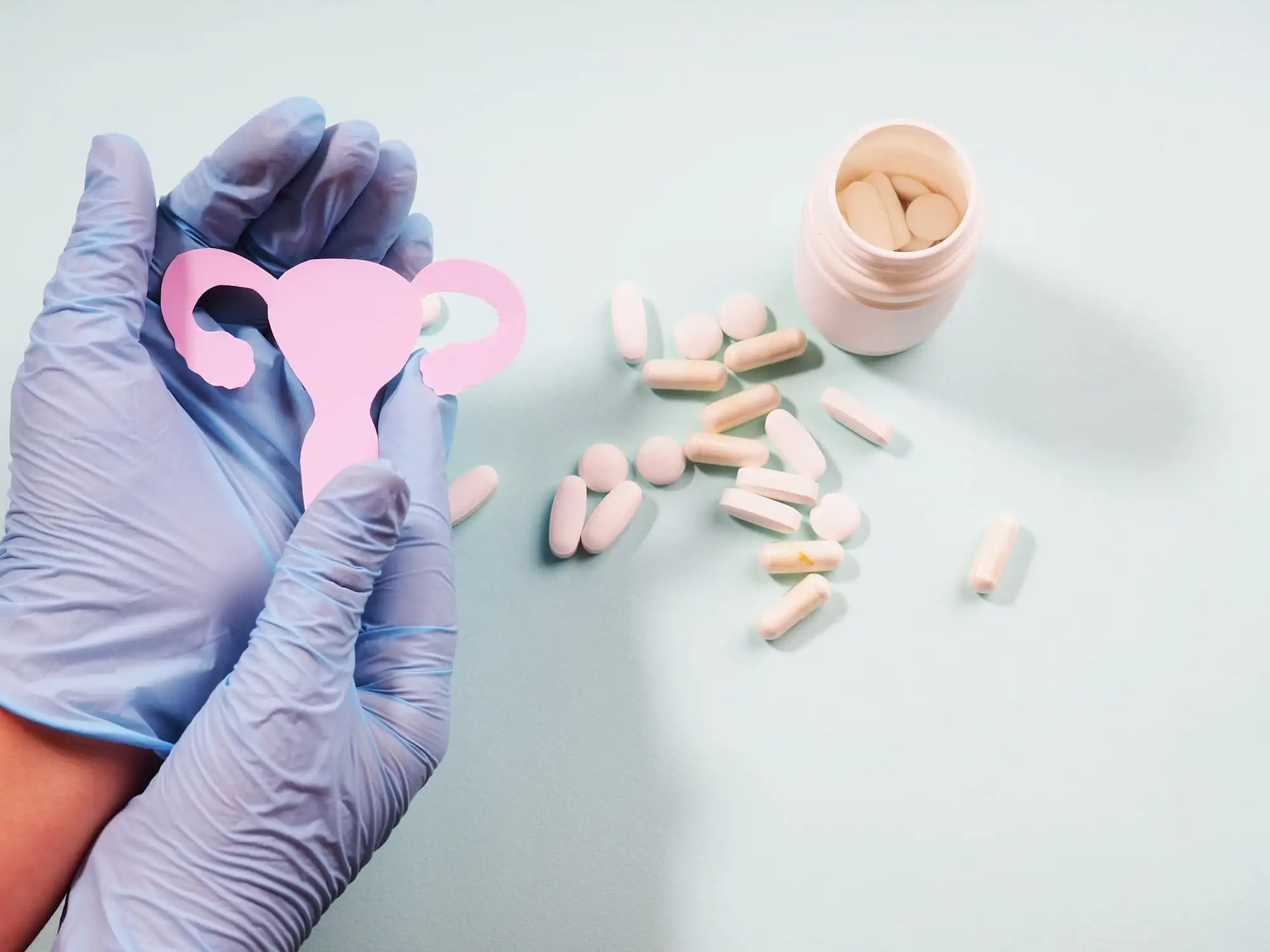 Polycystic ovary syndrome