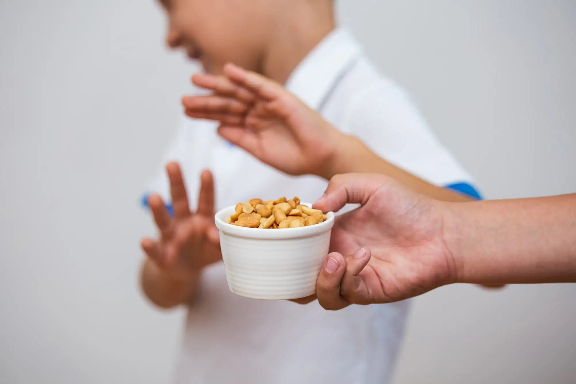 Peanut allergy