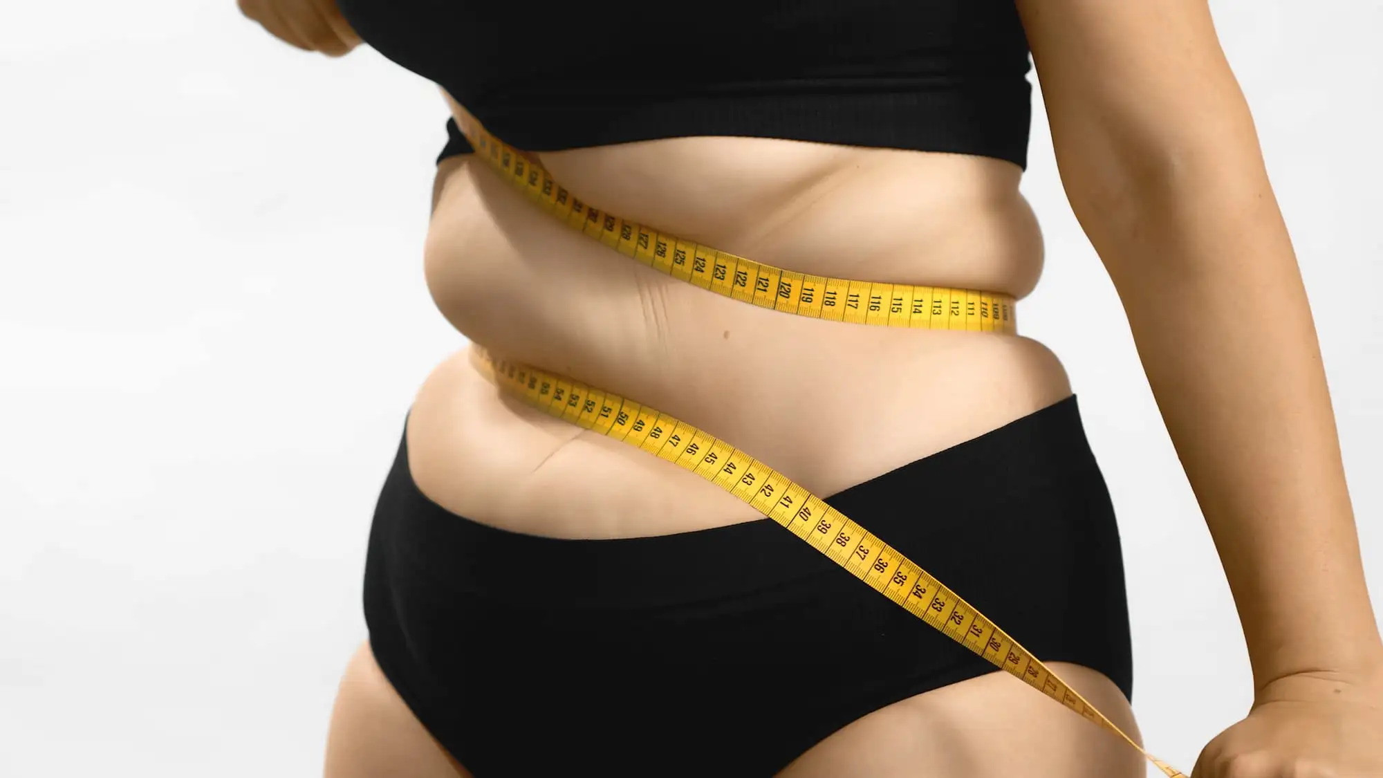 Liver fibrosis, Obesity