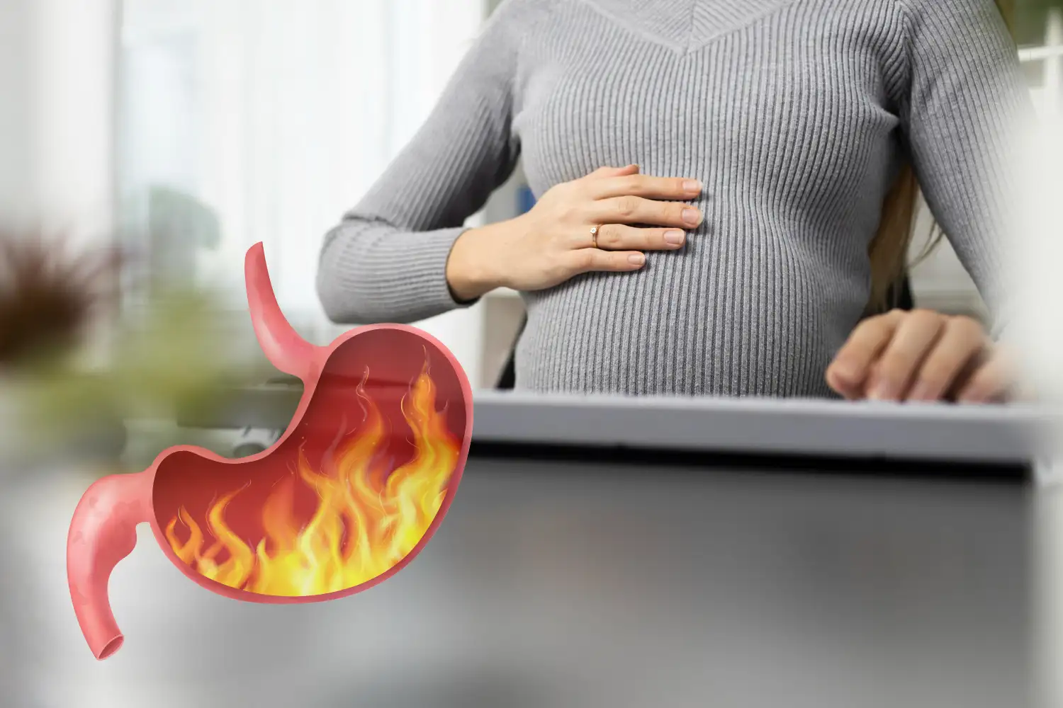 Gastroesophageal reflux disease in pregnancy