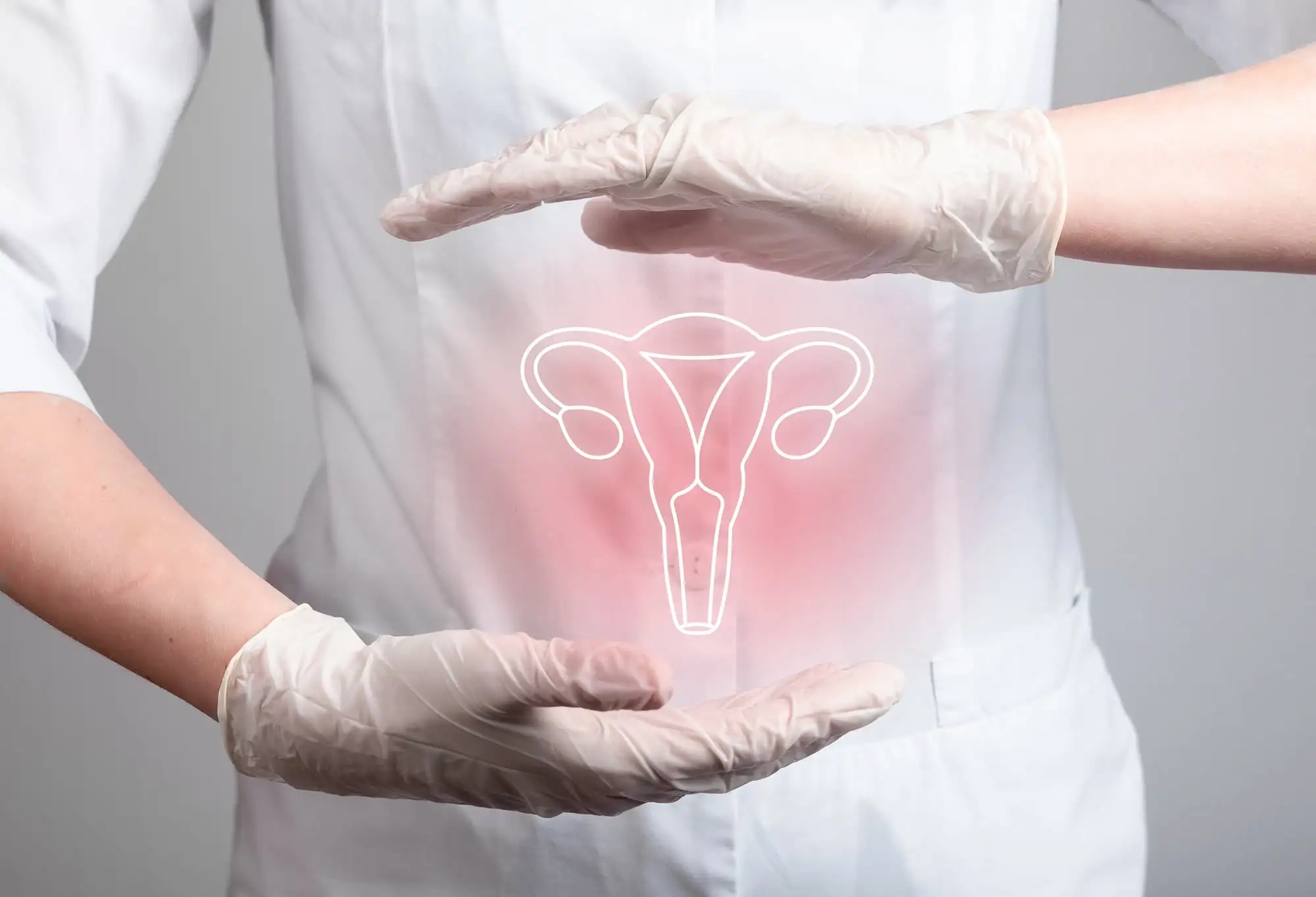 Endometriosis