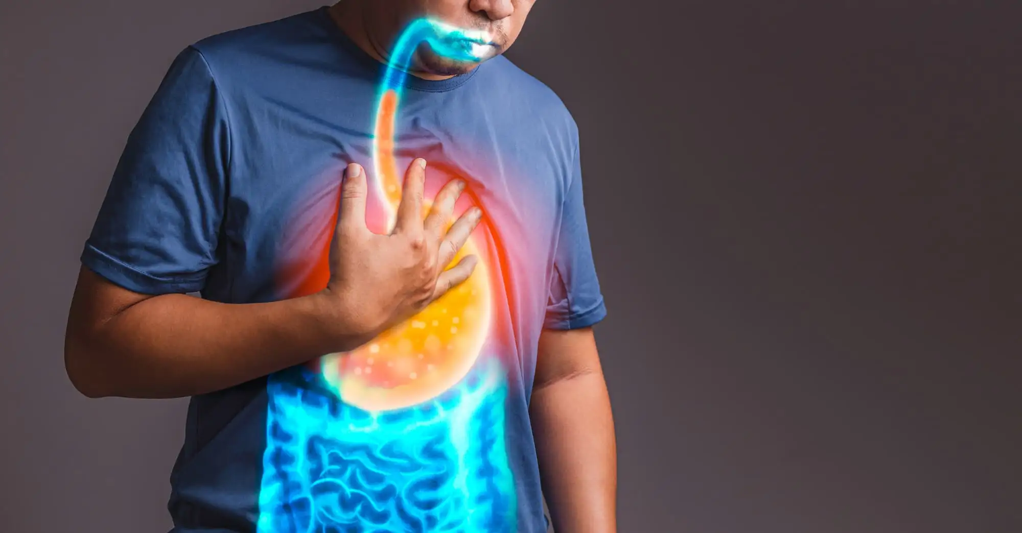 Non-erosive reflux disease