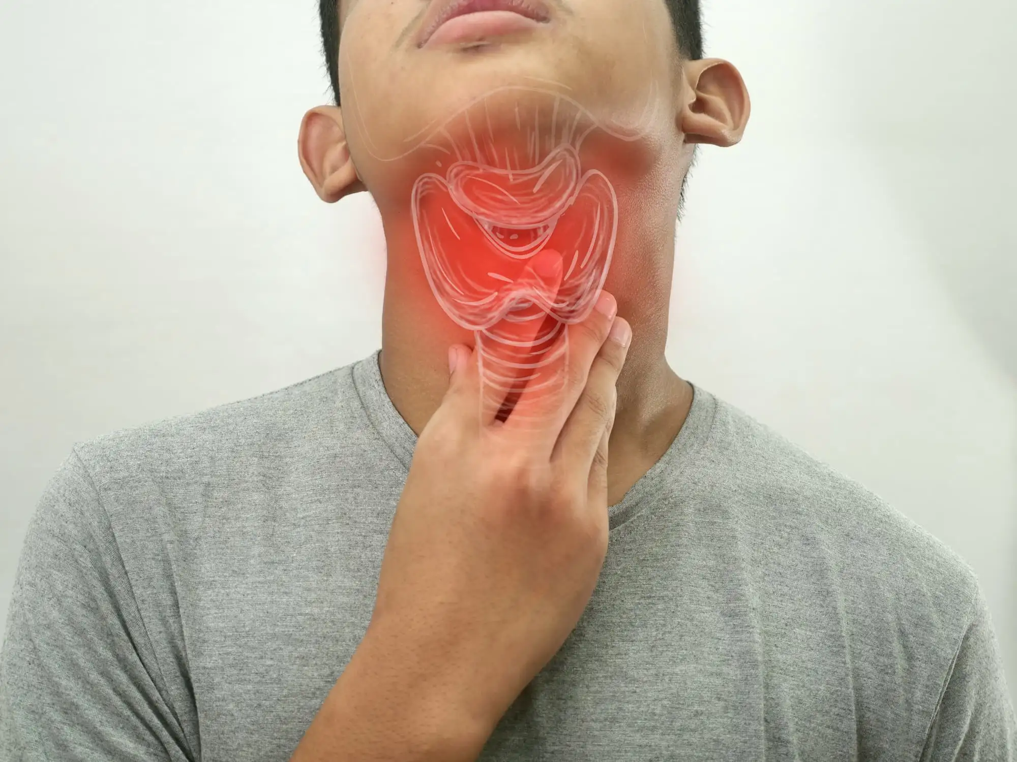 Post-tonsillectomy pain
