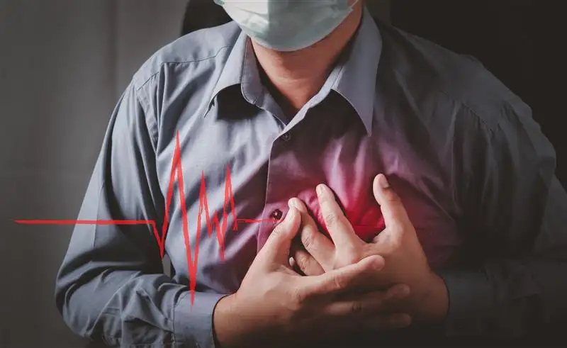 Myocardial infarction