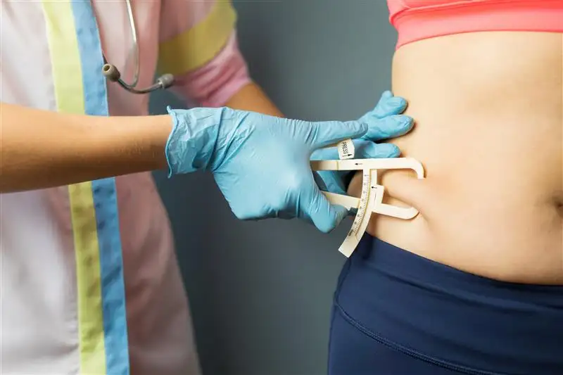 Obesity, Bariatric surgery