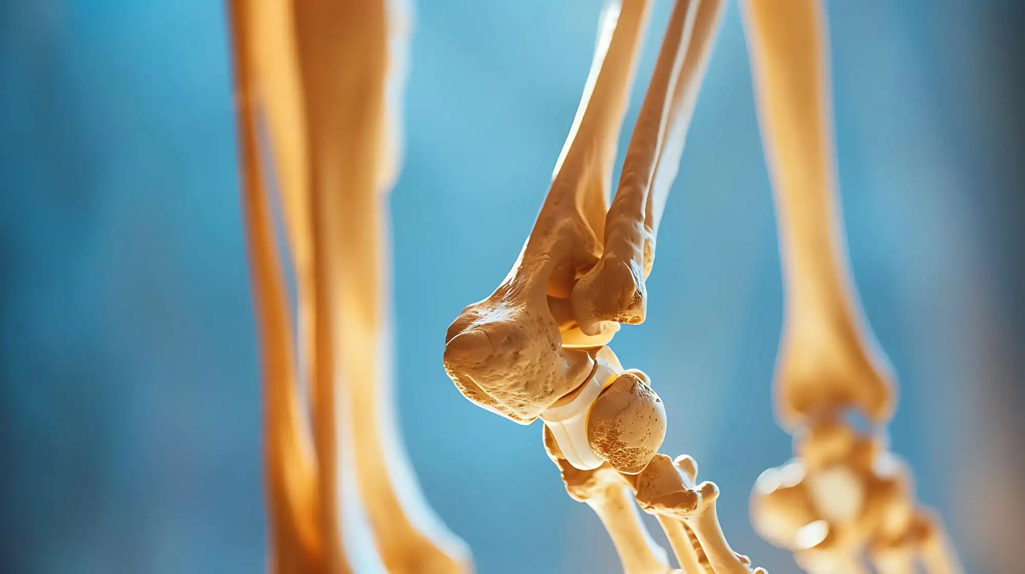 Osteoporosis