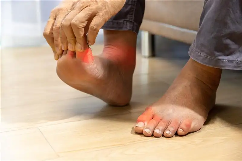 Peripheral neuropathy