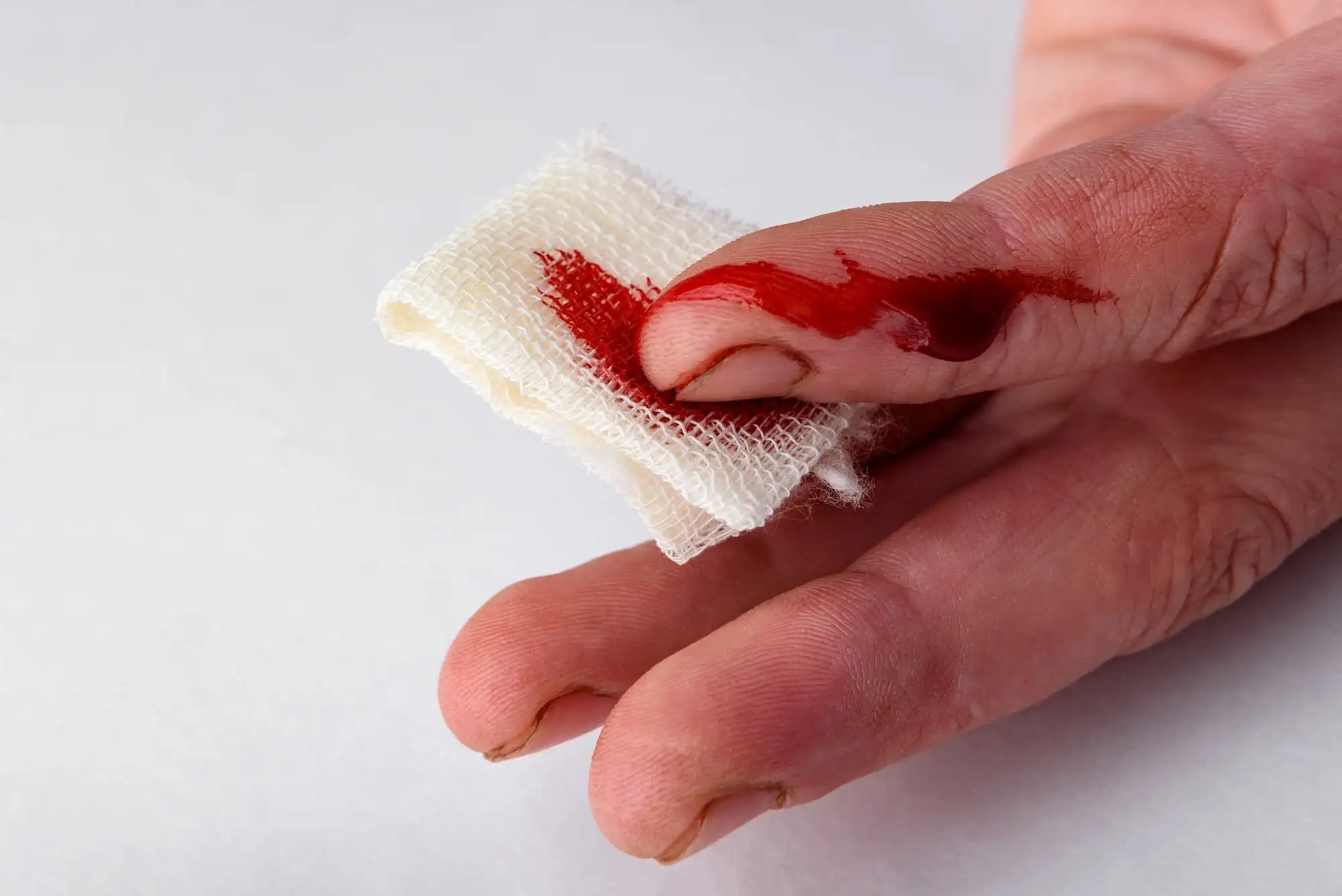 High bleeding risk