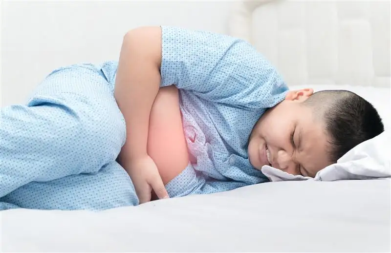 Acute appendicitis in children