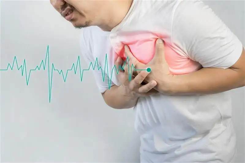 Atrial fibrillation
