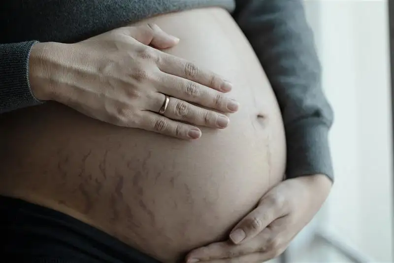 Pustular psoriasis of pregnancy