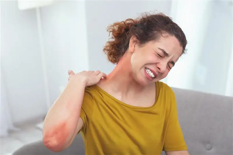 Penicillin allergy