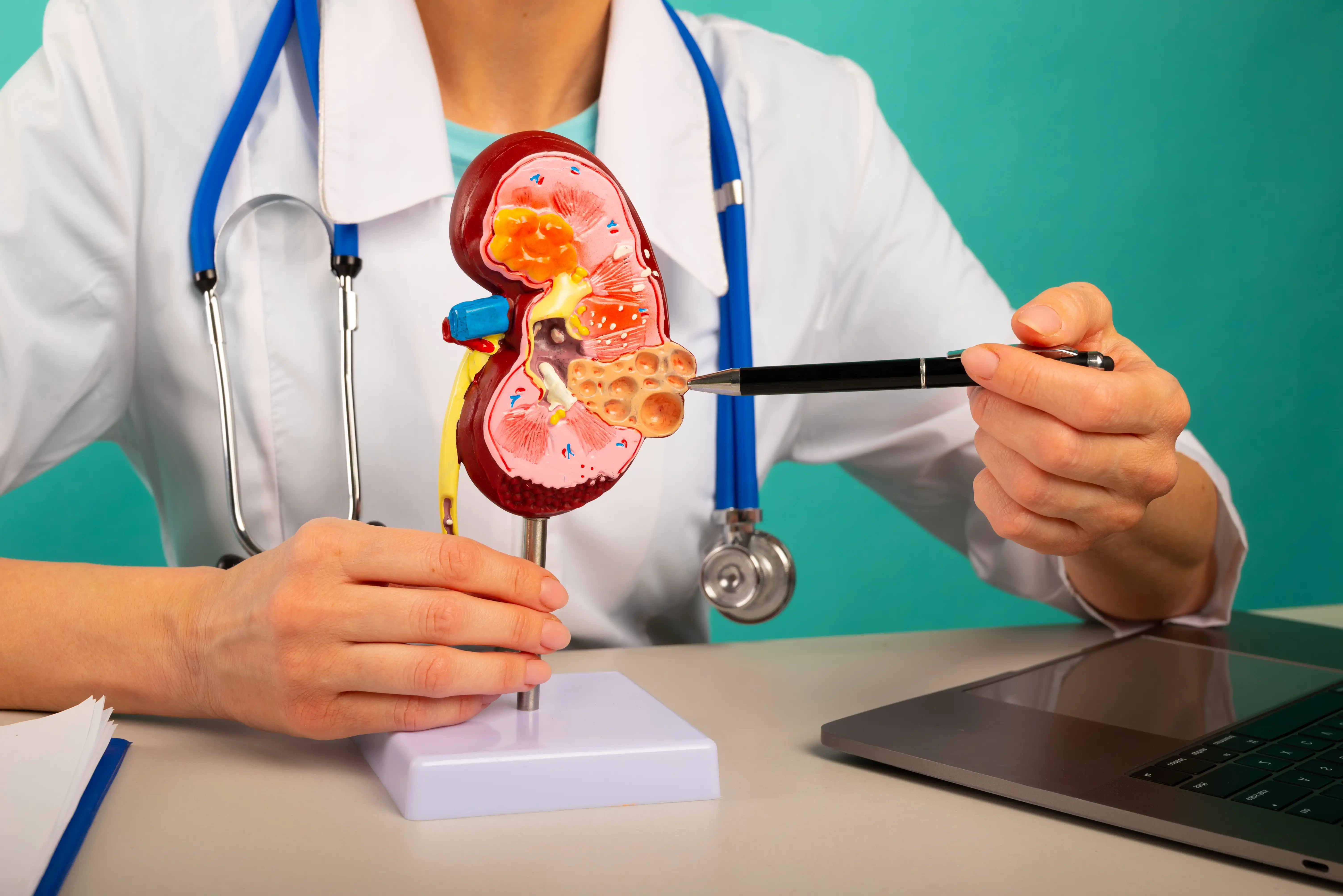 Acute kidney failure, Myocarditis