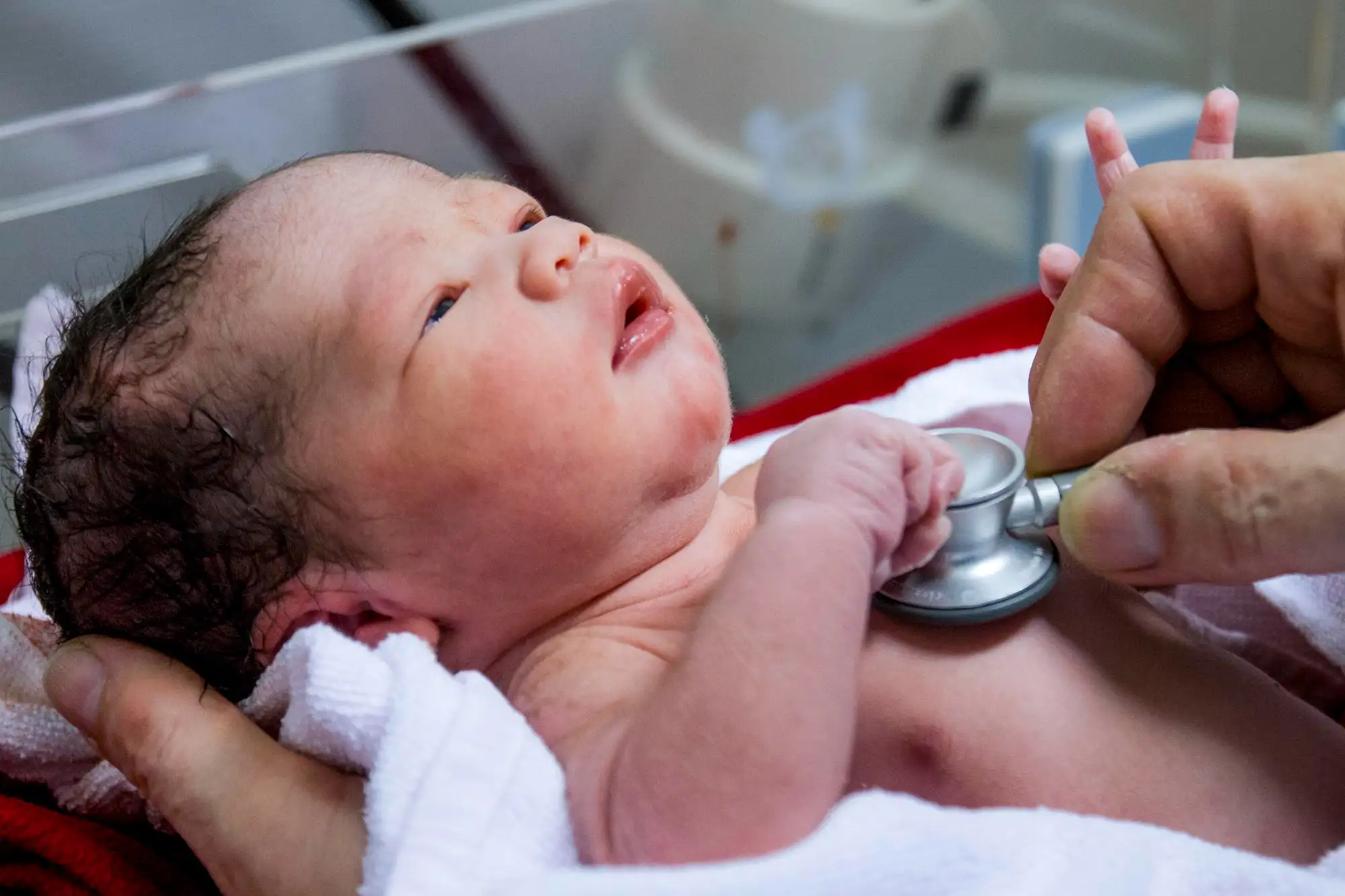 Patent ductus arteriosus