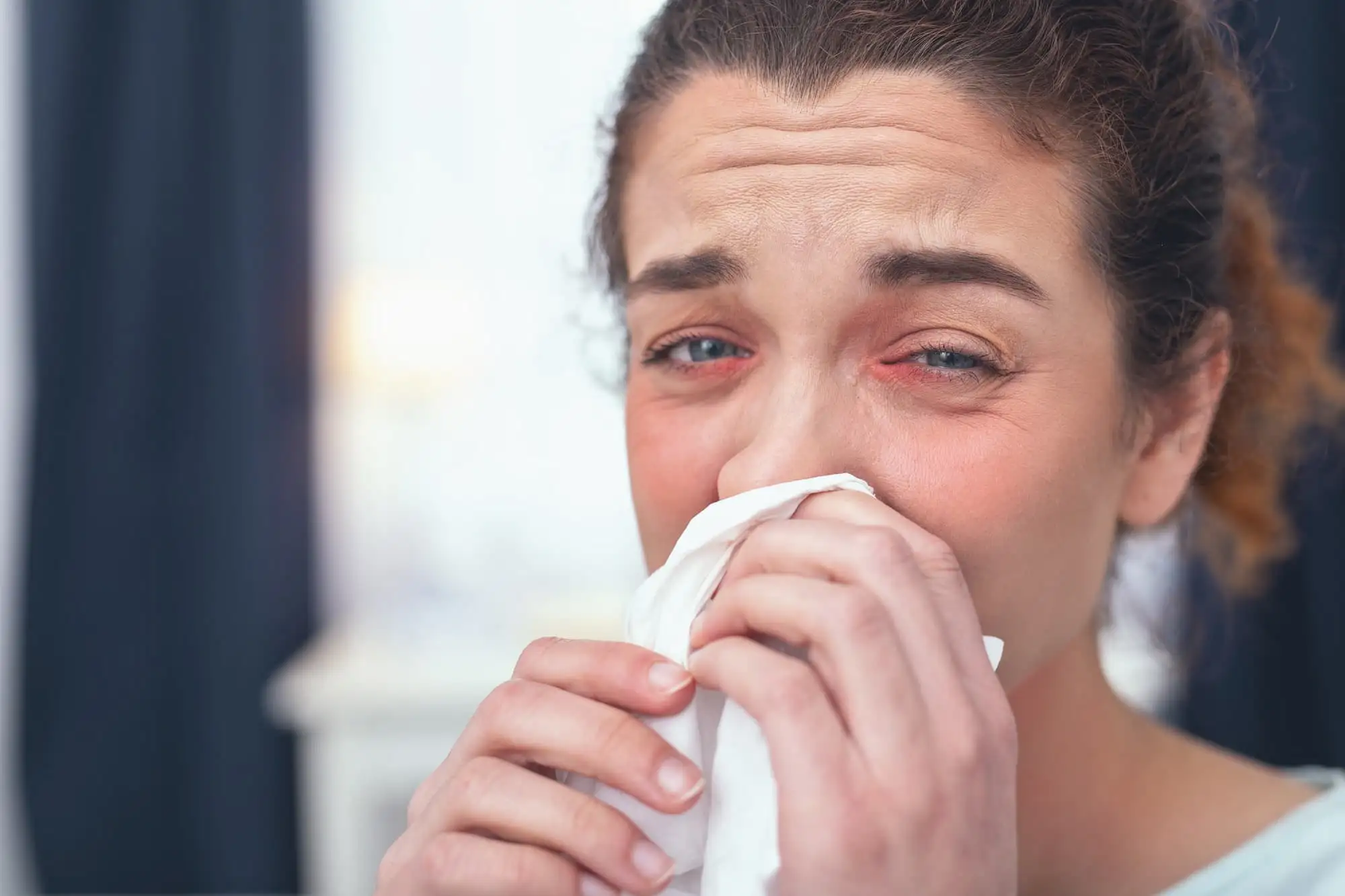 Allergic rhinitis