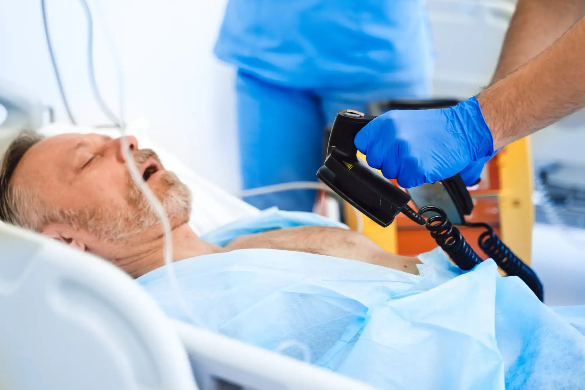 Atrial fibrillation
