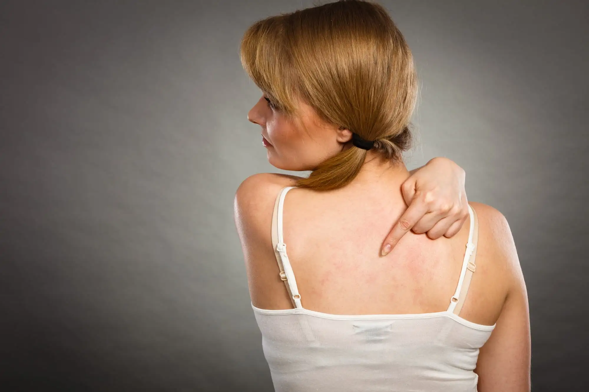 Chronic spontaneous urticaria