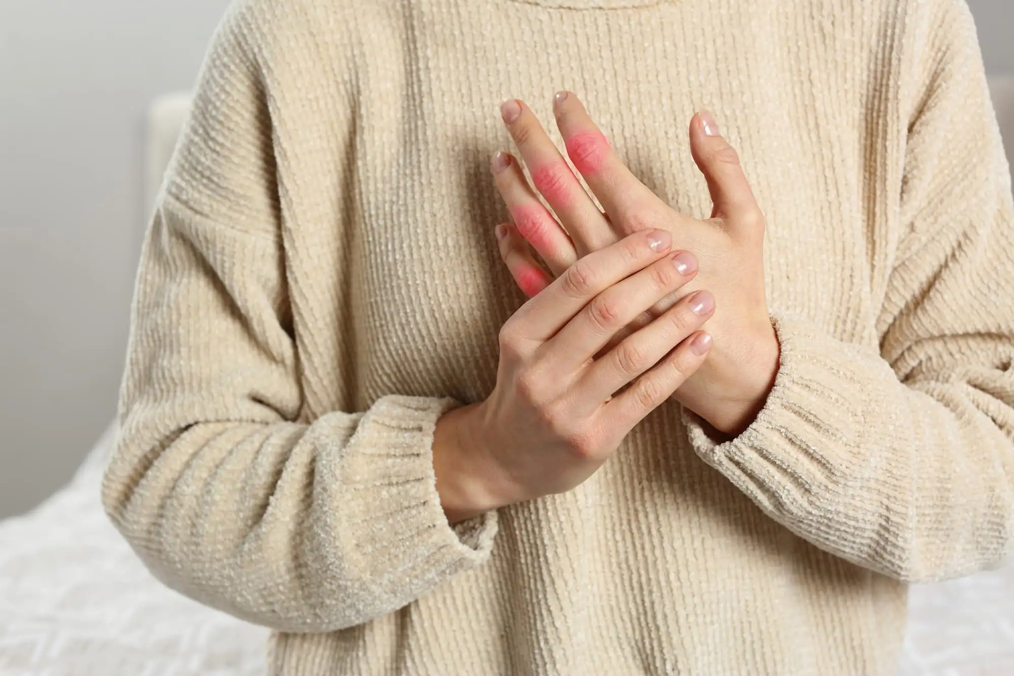 Systemic sclerosis