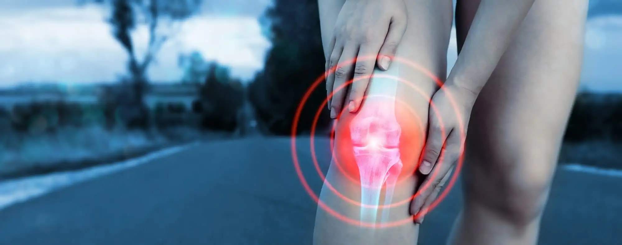 Medial compartment knee osteoarthritis