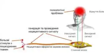 Види болю