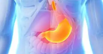 Hpylori_infection