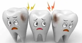 Root_canal_treatment