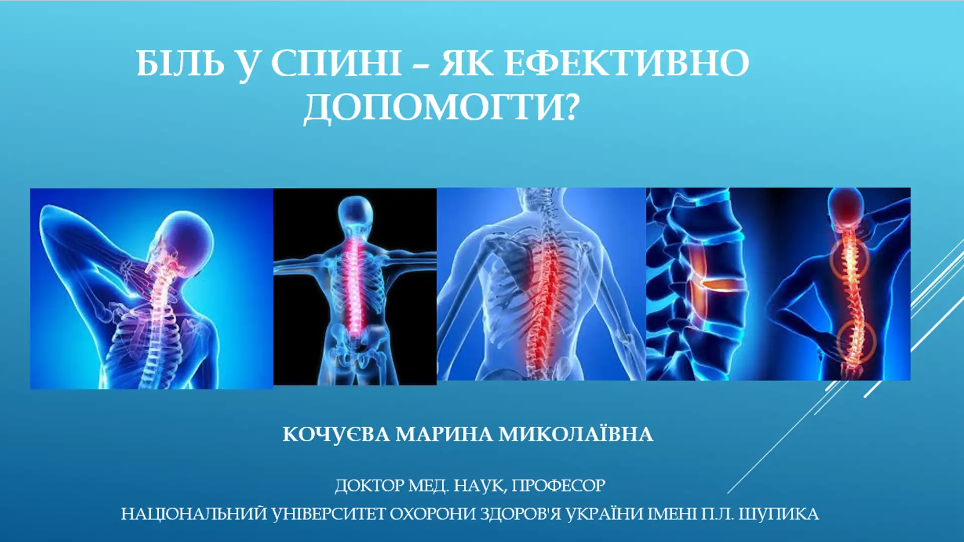 back pain - how to help